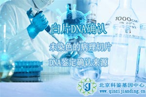 親子鑒定和個(gè)體識(shí)別結(jié)果哪個(gè)更可靠？