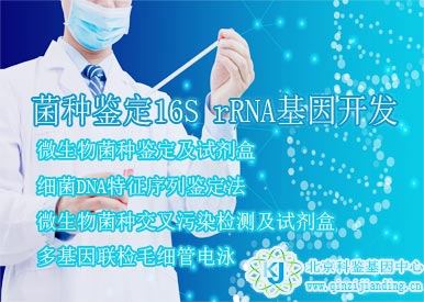 菌種鑒定16S rRNA基因開(kāi)發(fā)